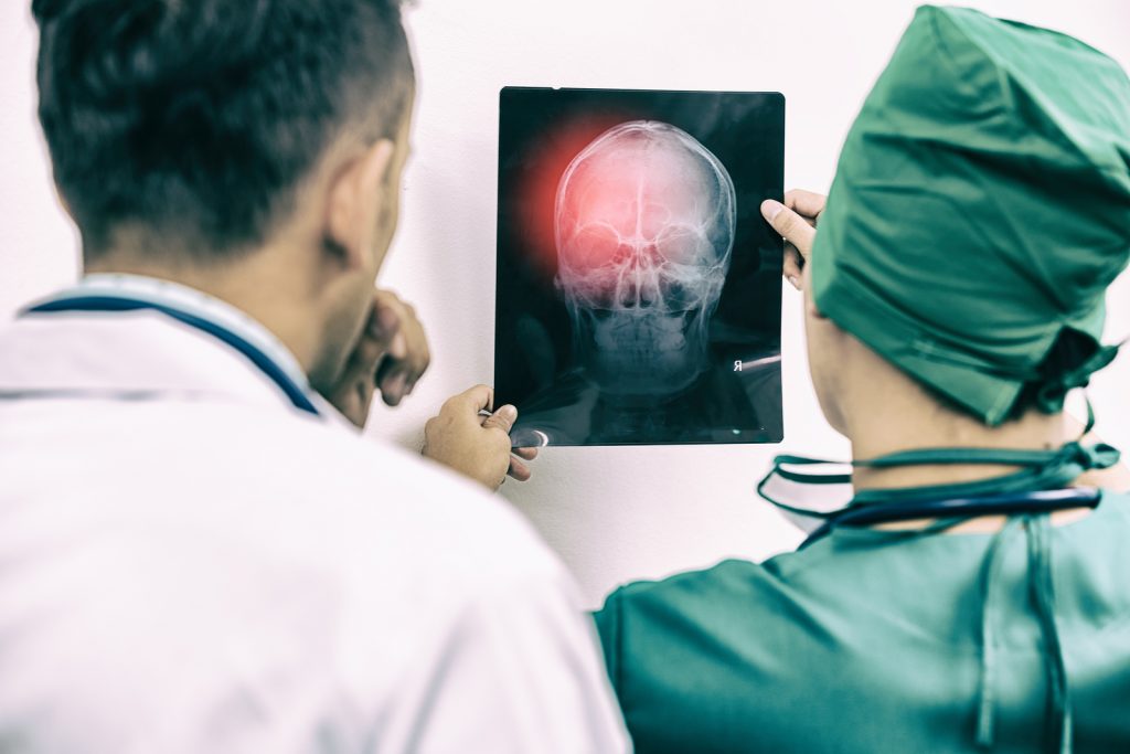 Halifax brain injury attorneys