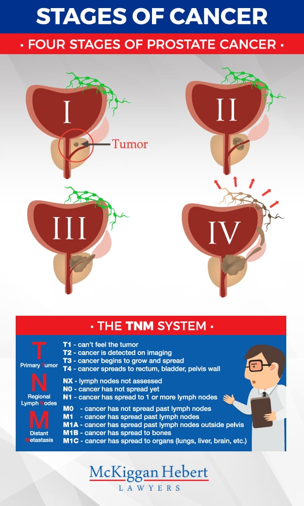 TNM-Stages-of-Cancer-Graphic